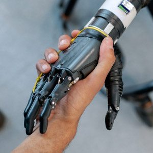 Handschlag zwischen einer normalen menschlichen Hand und einer dunkelgrauen Handprothese.